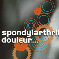 119 Ma Spondylarthrite, ma douleur